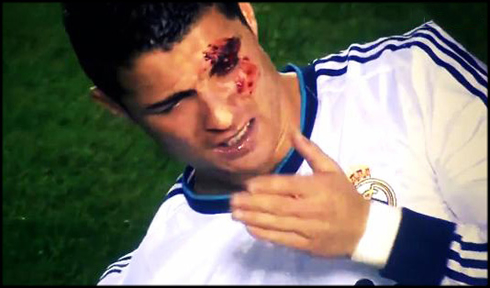 Christiano Ronaldo Injury History